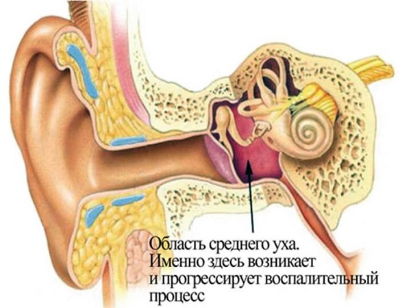 отит внутреннего уха