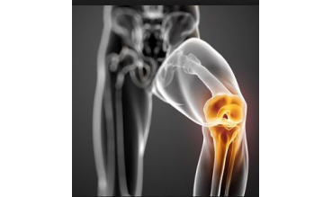 Хруст в коленях – причины и следствия