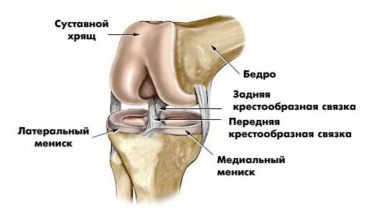 Боль в колене: поврежденный мениск коленного сустава